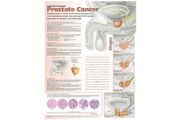 Rakovina prostaty 50,8x66cm